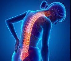 Degenerative Disc Disease