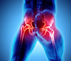 Hip Pain