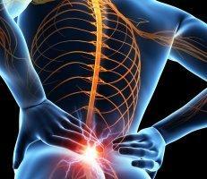 Low Back Pain
