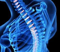Minimally Invasive Spine Surgery