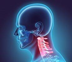 Neck Pain