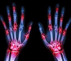 Neuropathy & Nerve Pain
