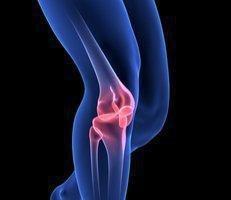 Orthopaedic Surgery