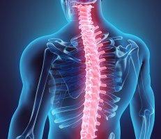 Spinal Stenosis