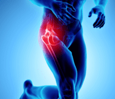 Sports Medicine