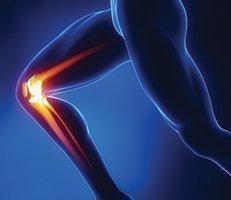 ACL Tear